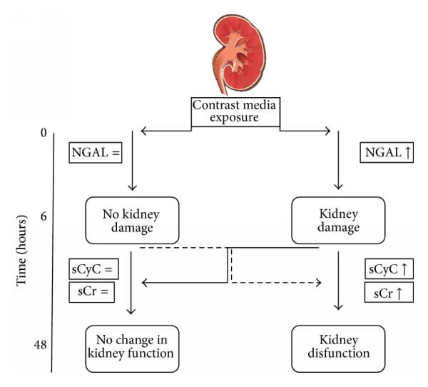 胱抑素C（CysC）與NGAL、肌酐的關(guān)系