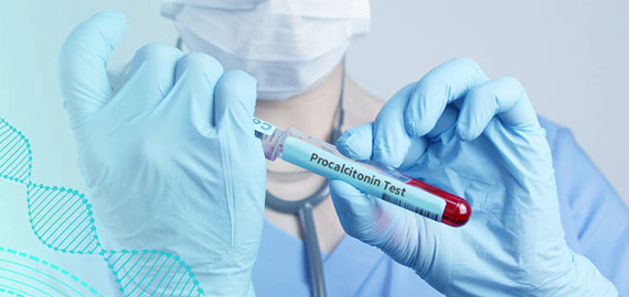 SingleB單抗發(fā)現技術(shù)攻克PCT檢測靈敏度難題 